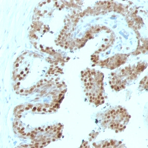 p57Kip2 (Mitotic Inhibitor/Suppressor Protein); Clone SPM308 (Concentrate)